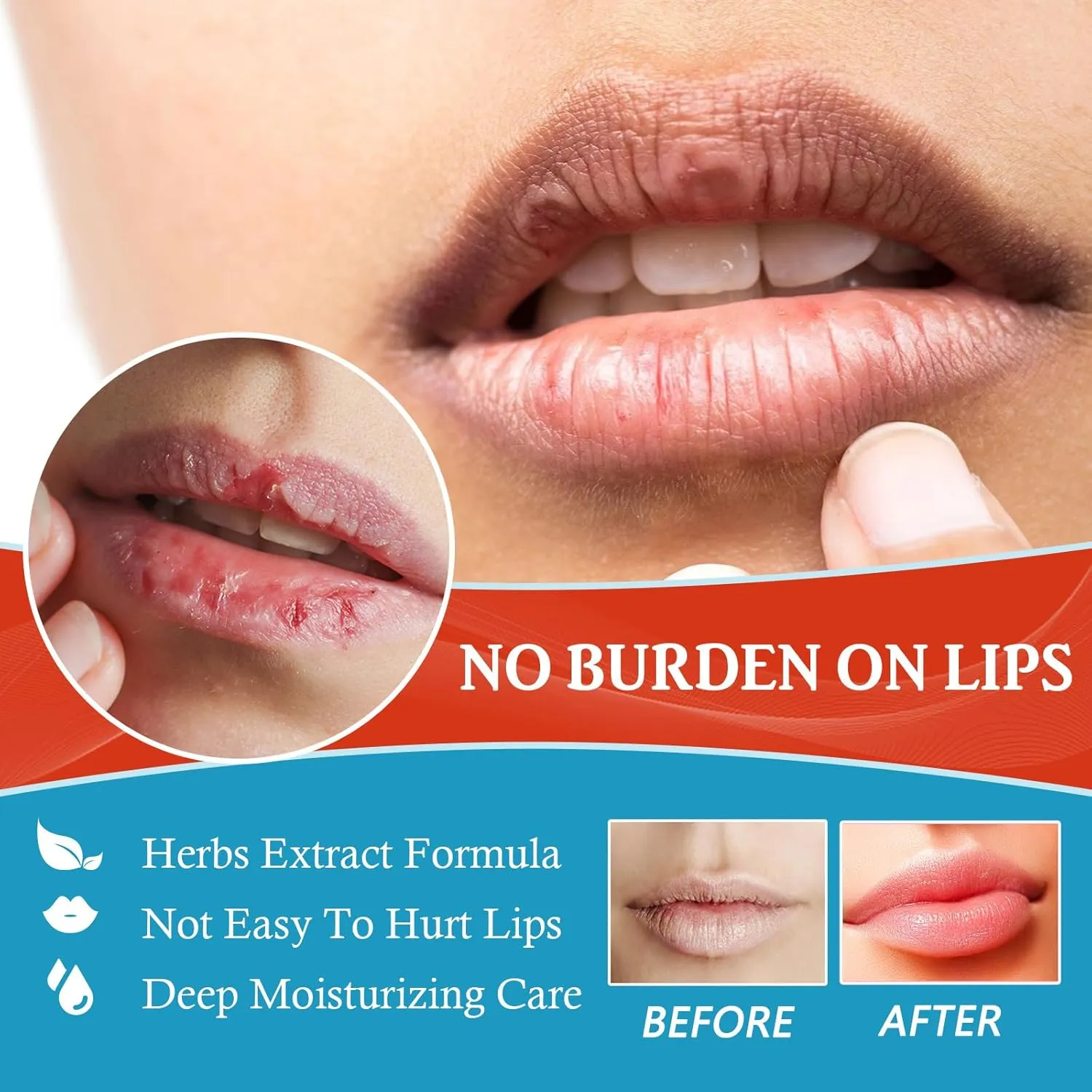 Lip Balm, Lip Lightening For Dark Lips, 20g Lip Balm Moisturizing, Lightening balm for Men and Women Moisturizer Essence, Moisturizing Brighten Lip Care Mask (1pcs)