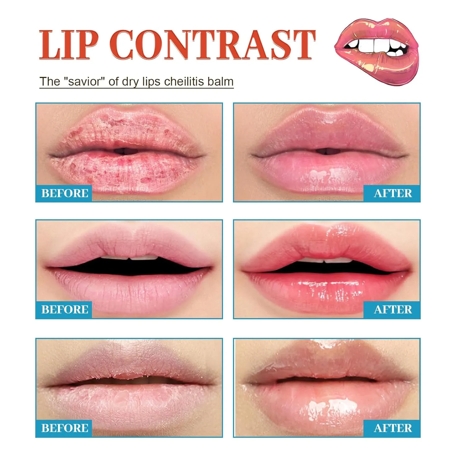 Lip Balm, Lip Lightening For Dark Lips, 20g Lip Balm Moisturizing, Lightening balm for Men and Women Moisturizer Essence, Moisturizing Brighten Lip Care Mask (1pcs)